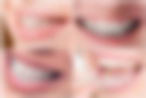 德州乐陵博雅王氏口腔诊所乐陵博雅王氏口腔诊所