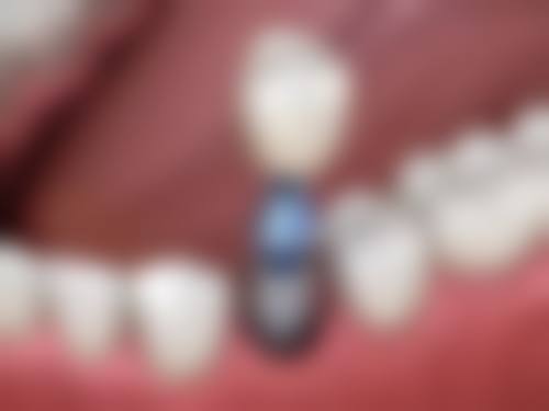 福州爱尚贝臣口腔门诊部收费价格表