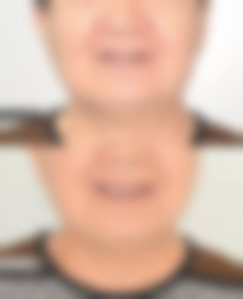 临床实战与真实实例