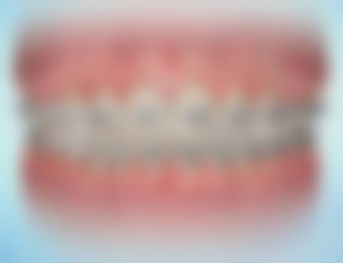 齐伯俊的临床实战与真实实例