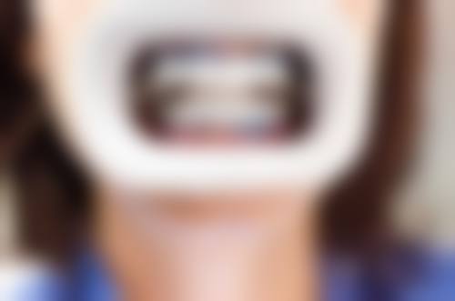 齐齐哈尔卓美口腔诊所怎么样预约挂号