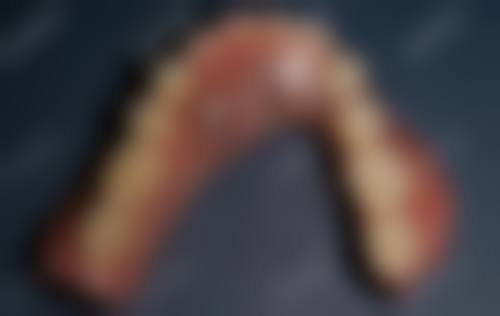 3. 时银根的临床实战与真实实例