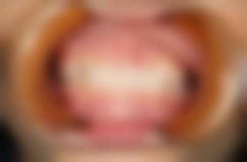 怡美口腔诊所是正规的吗