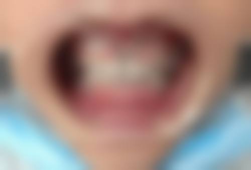 怡美口腔诊所口碑怎么样