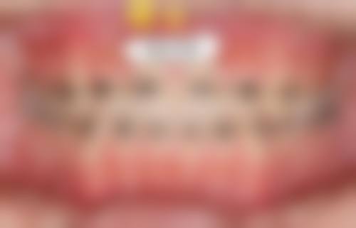 乌鲁木齐海力力口腔诊所收费价格表
