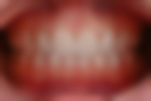 三、高瑶瑶的临床实战与真实实例

